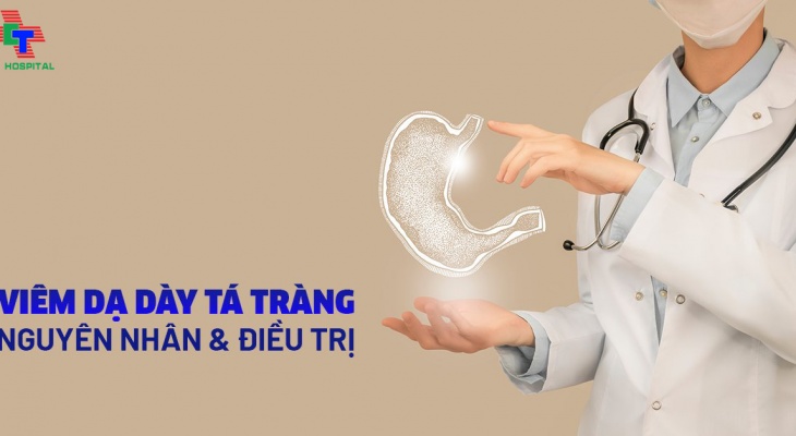 VIÊM DẠ DÀY TÁ TRÀNG: NGUYÊN NHÂN, TRIỆU CHỨNG, CHẨN ĐOÁN VÀ ĐIỀU TRỊ