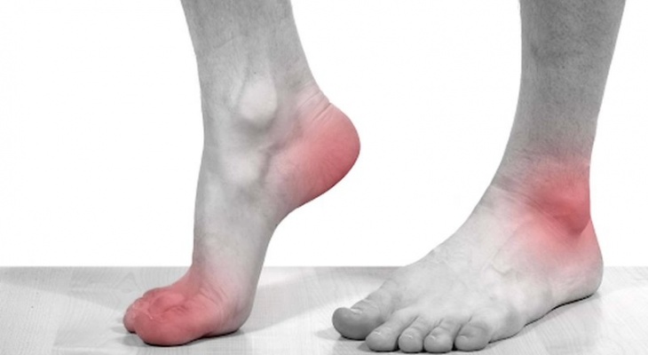 PHIẾU TÓM TẮT THÔNG TIN ĐIỀU TRỊ BỆNH GÚT.