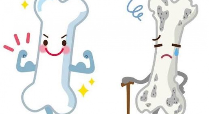 Ngày Phòng, chống loãng xương thế giới – World Osteomalacia day 20.10